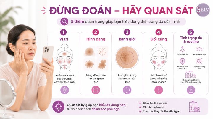 5 điểm giúp bạn phân biệt 5 điểm giúp bạn phân biệt