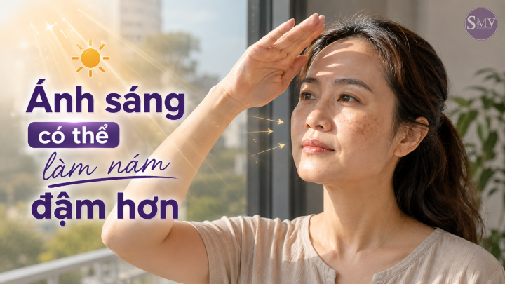 Ánh sáng có thể làm nám đậm hơn Ánh sáng có thể làm nám đậm hơn