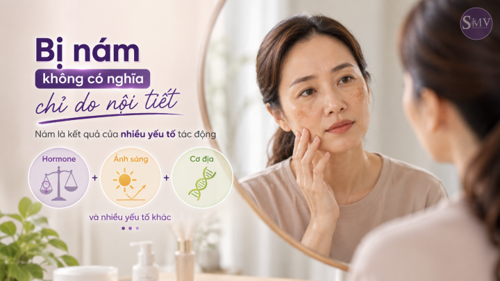 Bị nám không có nghĩa chỉ do nội tiết