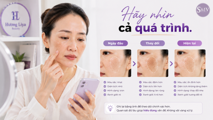Hãy nhìn cả quá trình. Hãy nhìn cả quá trình.