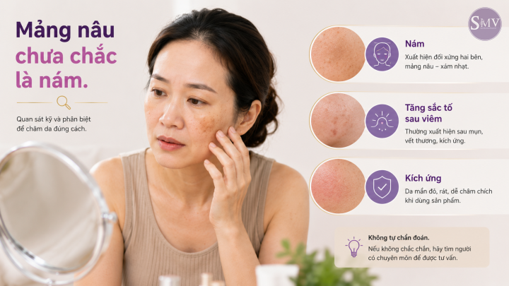 Mảng nâu chưa chắc là nám. Mảng nâu chưa chắc là nám.