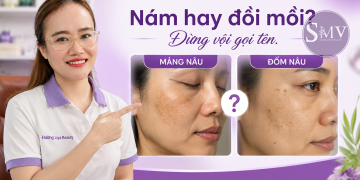 Nám hay đồi mồi Đừng vội gọi tên.