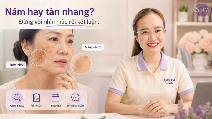 Nám hay tàn nhang