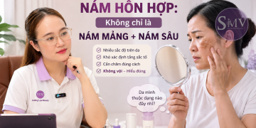 Nám hỗn hợp Không chỉ là nám mảng + nám sâu