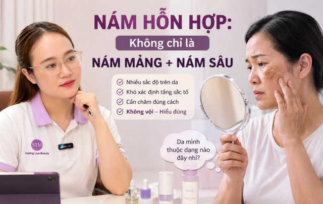 Nám hỗn hợp Không chỉ là nám mảng + nám sâu
