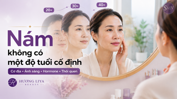 Nám không có một độ tuổi cố định Nám không có một độ tuổi cố định