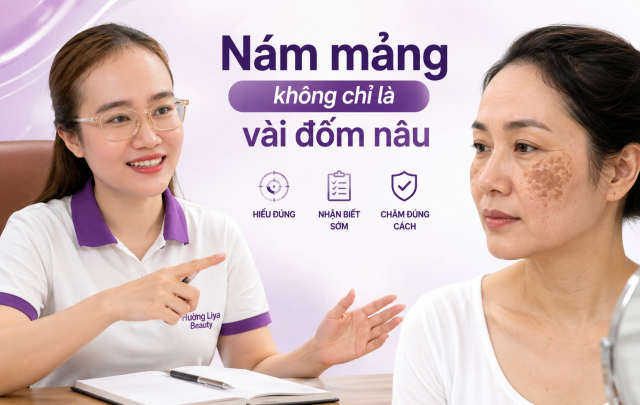 Nám mảng không chỉ là vài đốm nâu