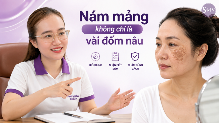 Nám mảng không chỉ là vài đốm nâu