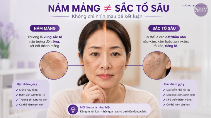 Nám mảng ≠ sắc tố sâu Nám mảng ≠ sắc tố sâu