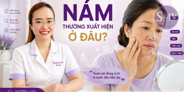 Nám thường xuất hiện ở đâu