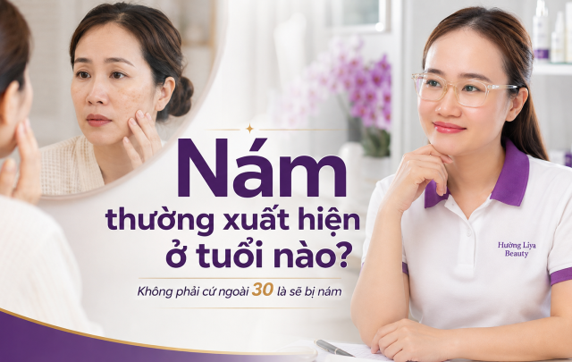 Nám thường xuất hiện ở tuổi nào