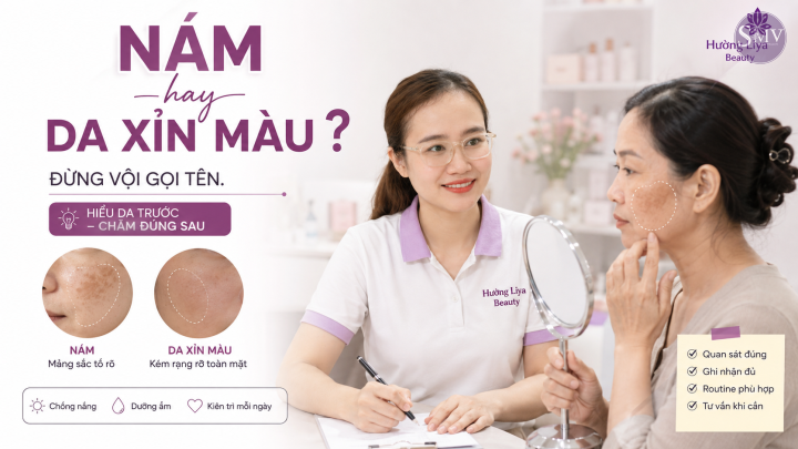Nám và da xỉn màu khác nhau thế nào