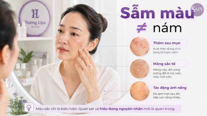 Sẫm màu ≠ nám Sẫm màu ≠ nám