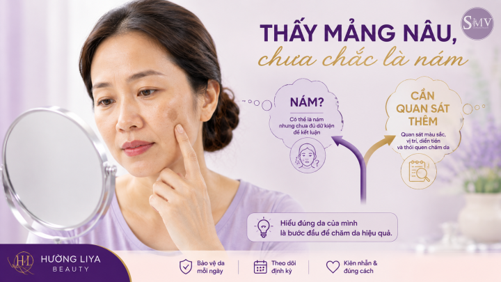 Thấy mảng nâu, chưa chắc là nám Thấy mảng nâu, chưa chắc là nám