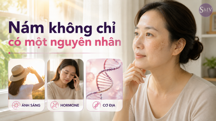 Vì sao nám xuất hiện và đậm hơn Vì sao nám xuất hiện và đậm hơn