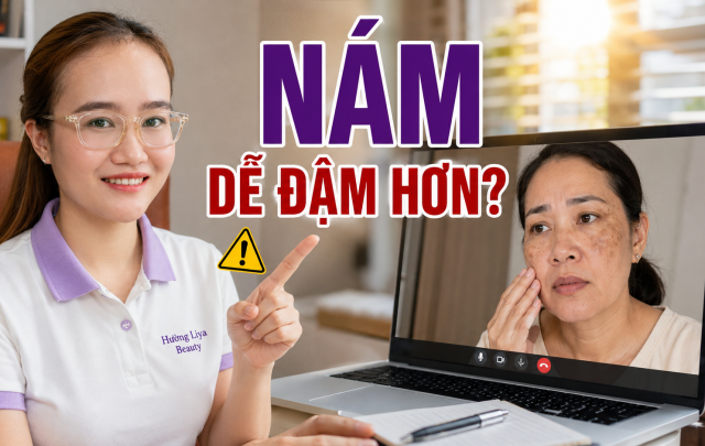 Vì sao tia UV làm nám dễ đậm hơn