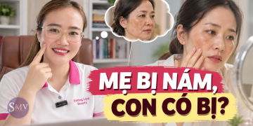 Nám có yếu tố gia đình không Hiểu đúng để chăm sóc da sớm