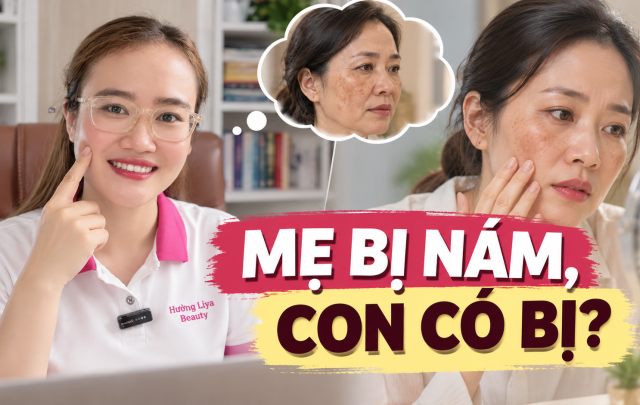 Nám có yếu tố gia đình không Hiểu đúng để chăm sóc da sớm
