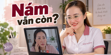 Nám sau sinh có gì đặc biệt 7 điều mẹ cần biết để chăm da