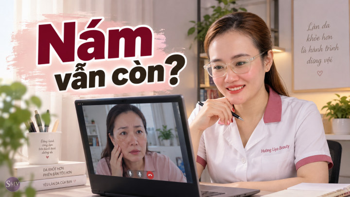 Nám sau sinh có gì đặc biệt 7 điều mẹ cần biết để chăm da