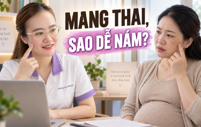 Vì sao nám thường xuất hiện khi mang thai Hiểu đúng để chăm da
